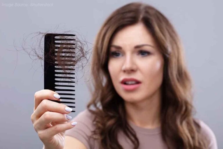 Dandruff problem increases in winter